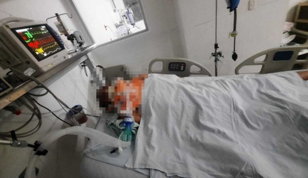 Habitante de calle electrocutado, a la espera de atención especial