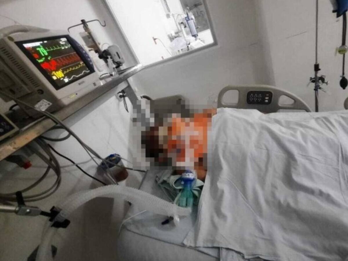 Habitante de calle electrocutado, a la espera de atención especial