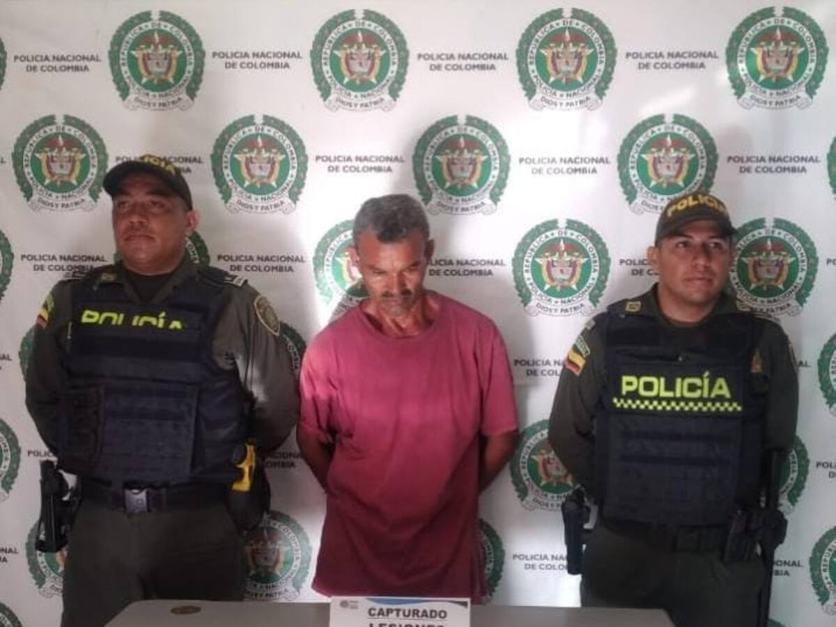 Hombre habría agredido con un ladrillo a su hermano en Arjona: la víctima está en UCI