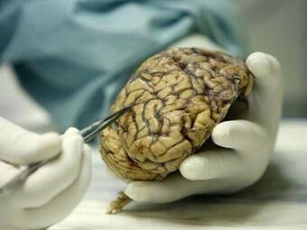 Cerebro humana. Foto: EFE