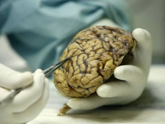 Cerebro humana. Foto: EFE