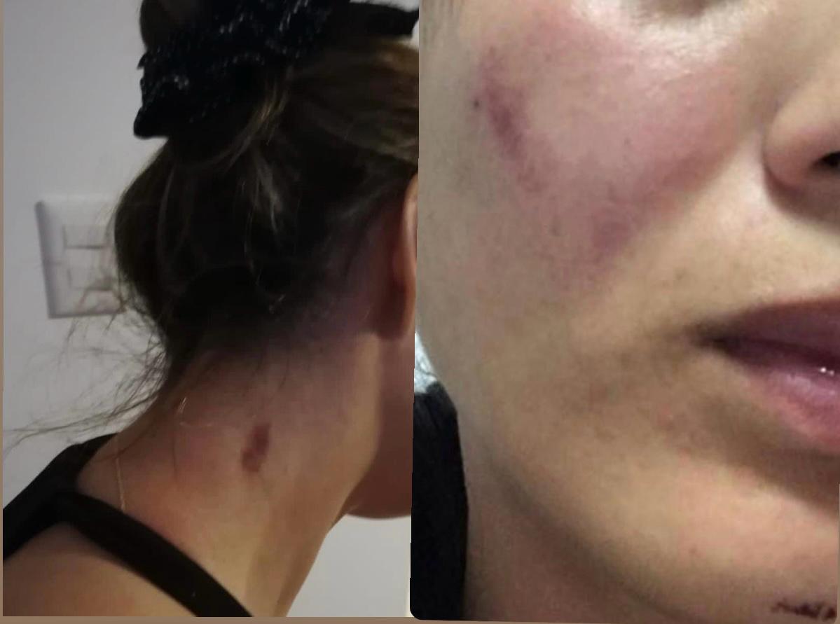 Crédito: Suministrada por la víctima.