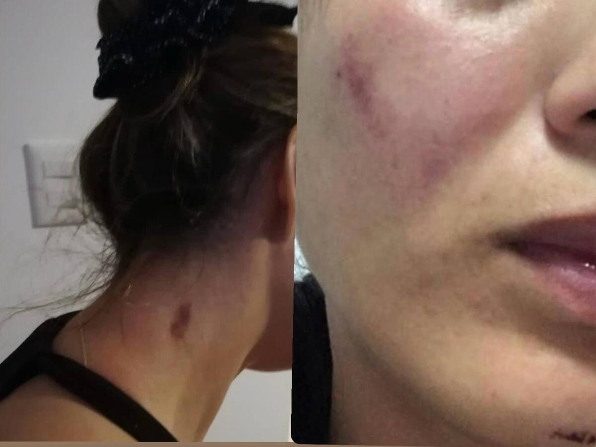 Estoy inconforme con la decisión del juez: mujer víctima de posible maltrato de un abogado