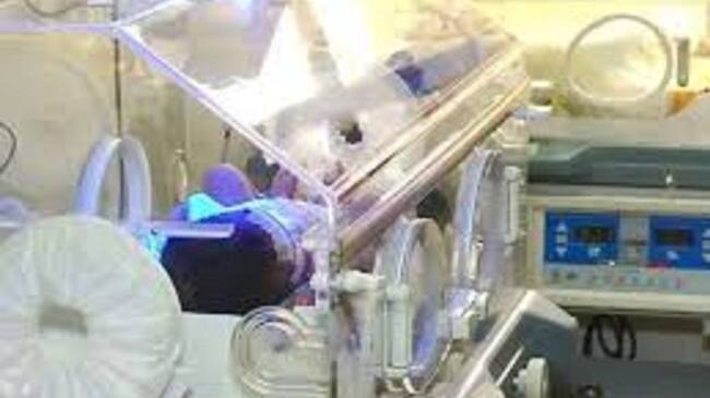 Preocupación por el aumento de casos de desnutrición en el Tolima