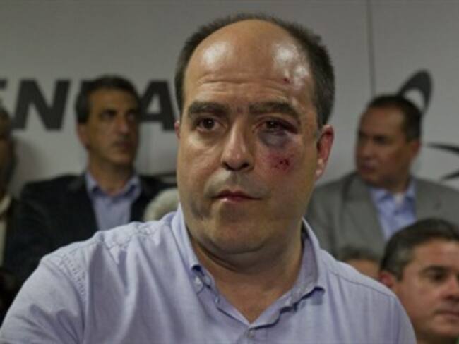 Estados Unidos "muy preocupado" por enfrentamientos violentos en Asamblea venezolana