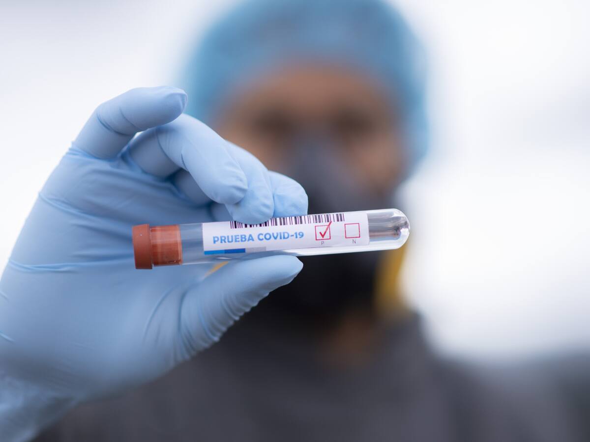 33 casos de COVID – 19 en la última semana en Caldas