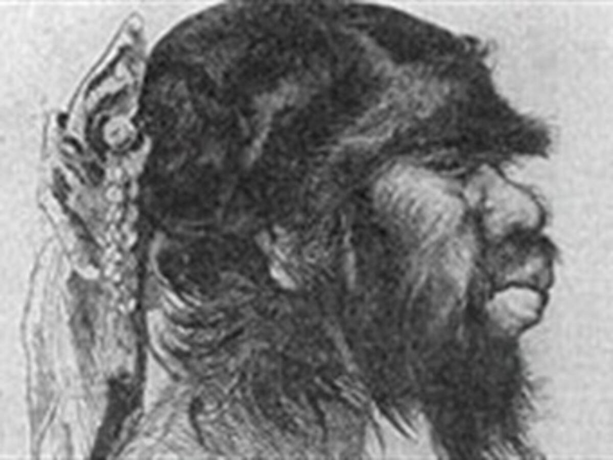 La ciencia descifra el misterio de la mujer barbuda