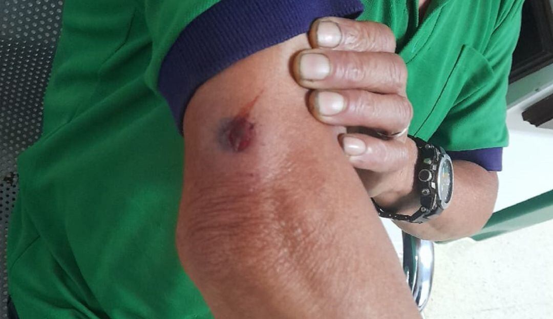 Foto: Hombre herido al parecer con arma traumática en Pácora, Caldas