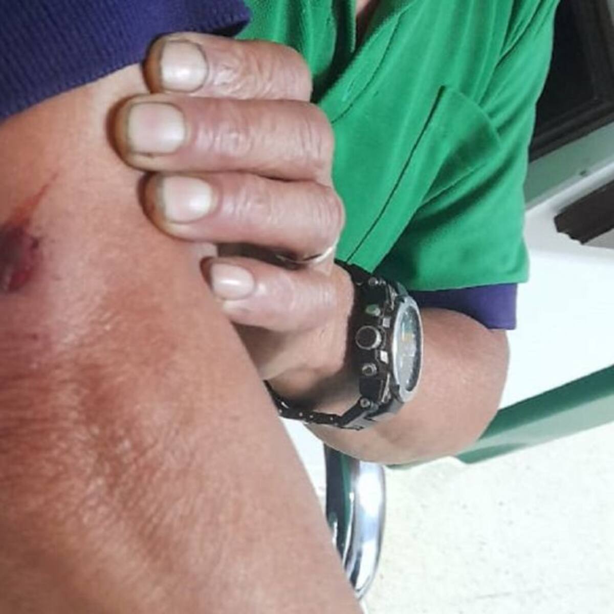 En Pácora, hombre fue herido en su brazo, al parecer con un arma traumática