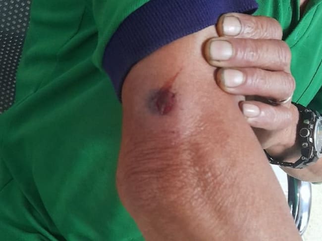 Foto: Hombre herido al parecer con arma traumática en Pácora, Caldas