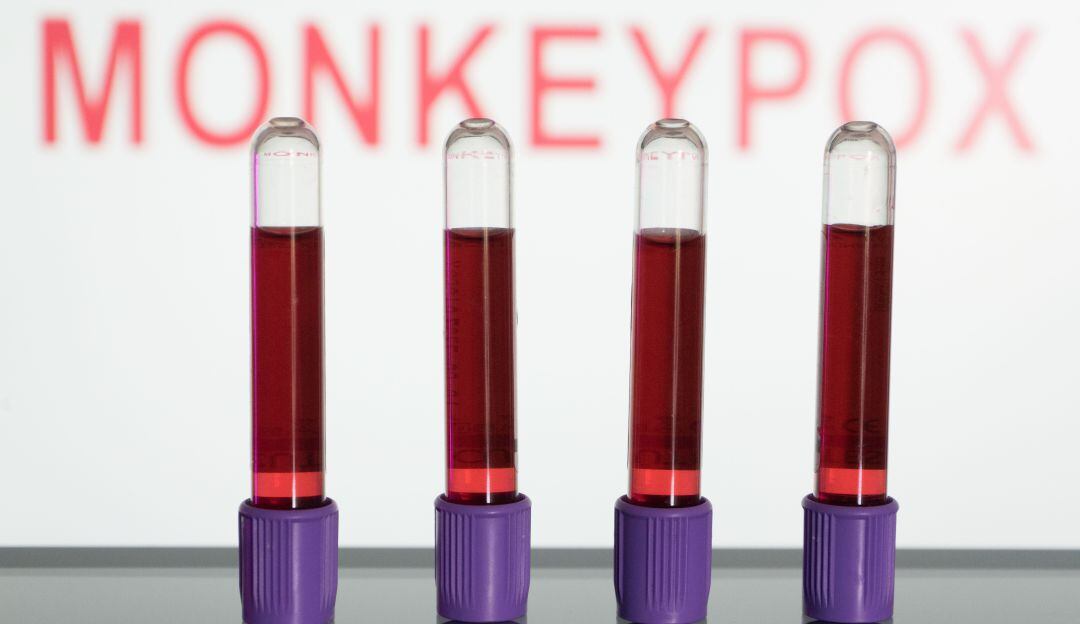 Viruela del mono o Monkeypox