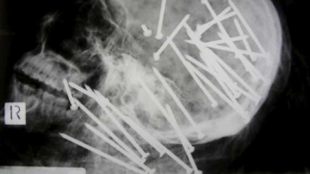 Matan a un inmigrante chino de 34 disparos en la cabeza con una pistola de clavos