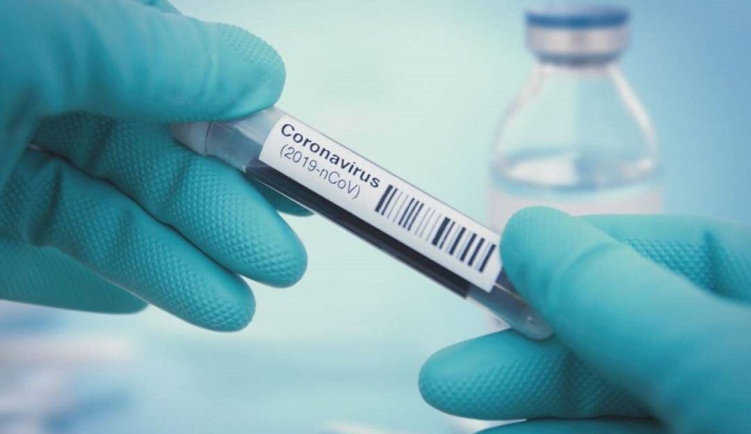 Imagen de referencia