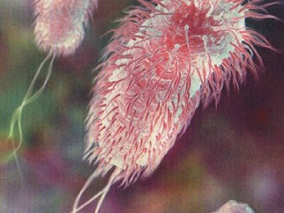 Investigan si hombre en Montería padece variedad mortal de la bacteria E Coli