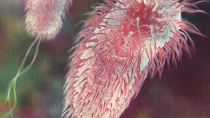 Investigan si hombre en Montería padece variedad mortal de la bacteria E Coli