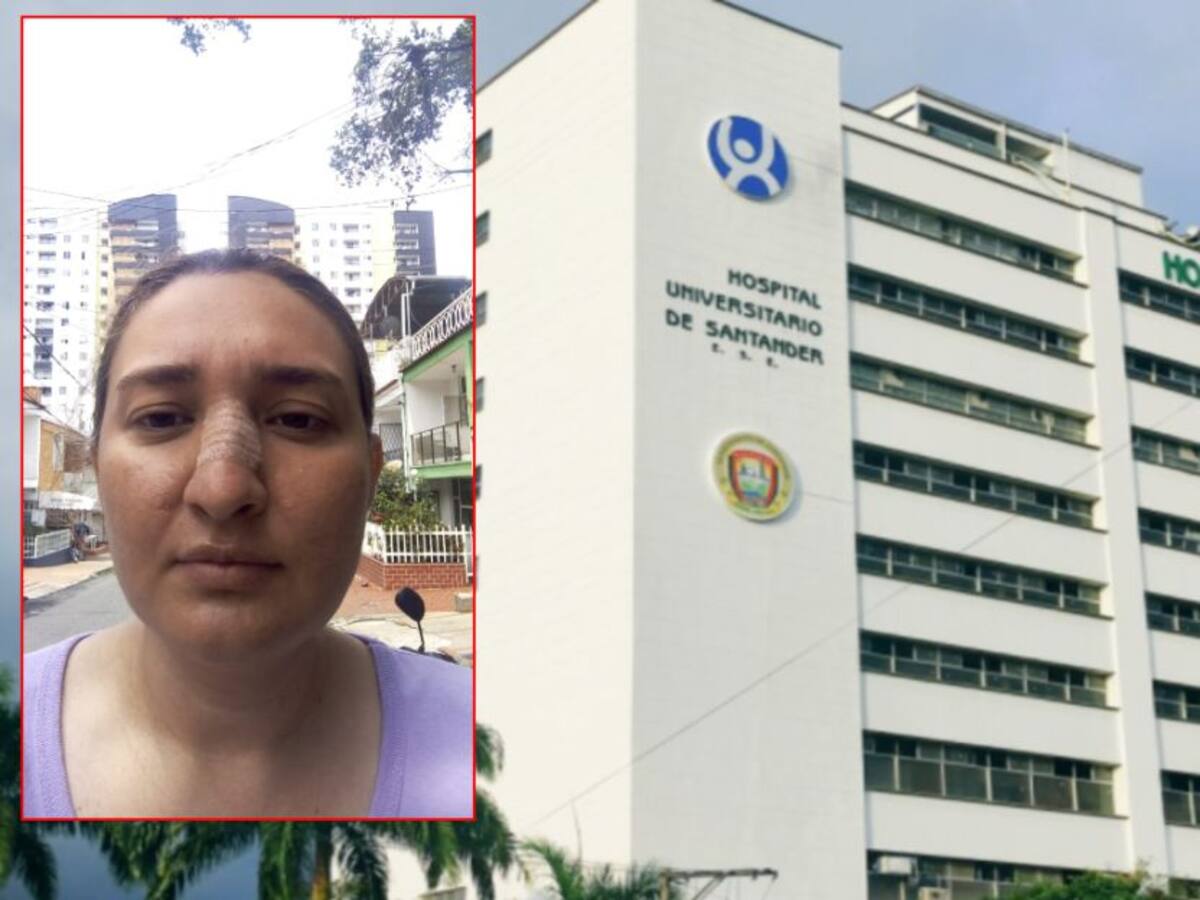 Enfermera sufrió fractura de naríz, tras agresión de paciente