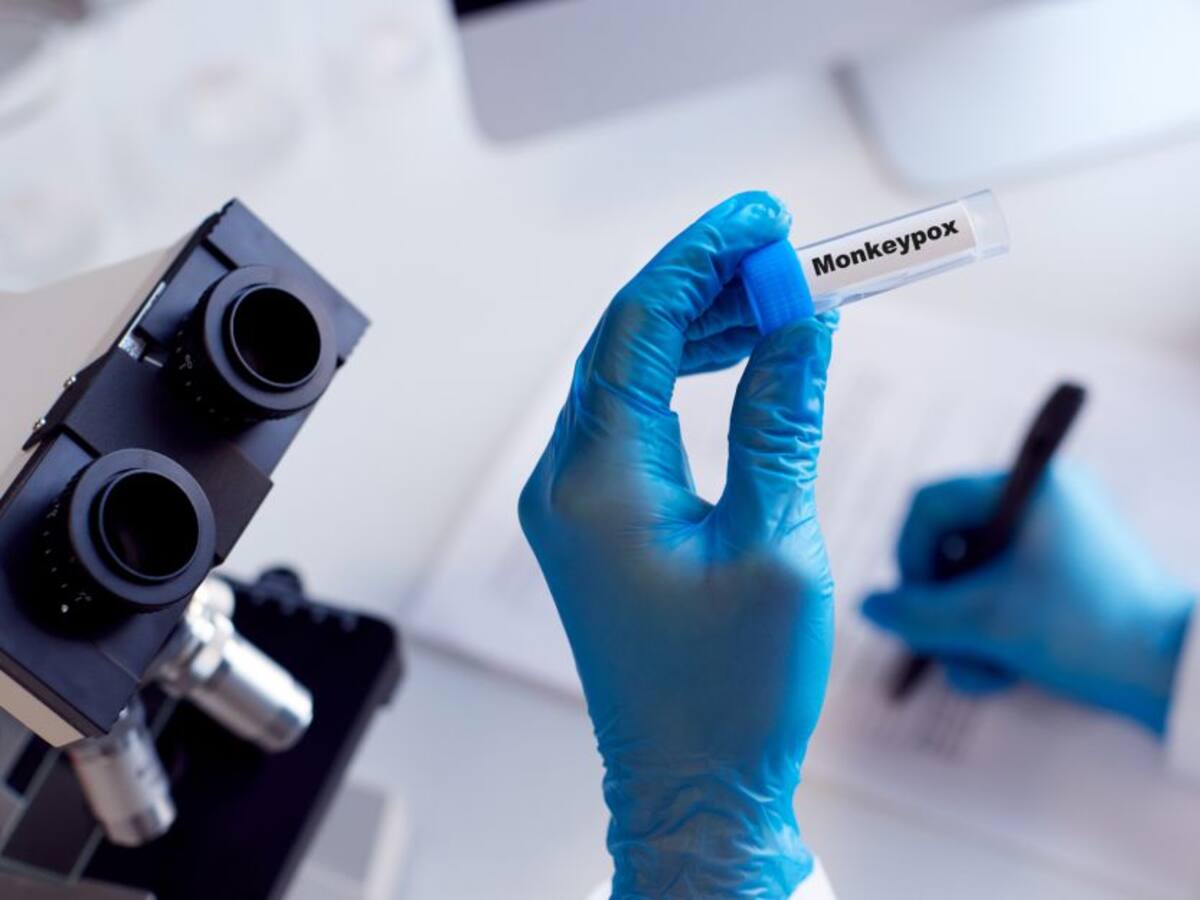 Viruela del mono en Colombia: Bogotá tiene dos casos confirmados