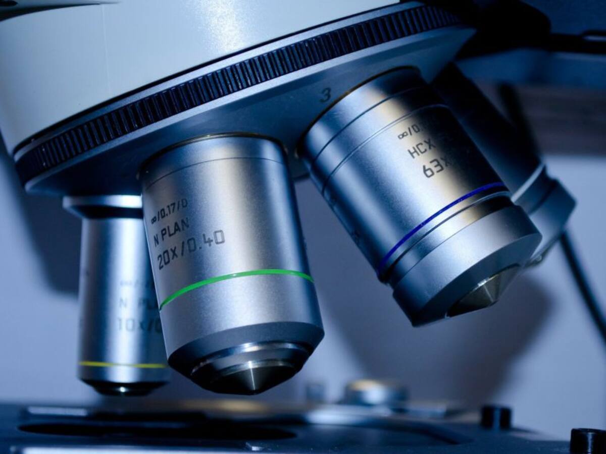 Aunque sean raras requieren gran atención