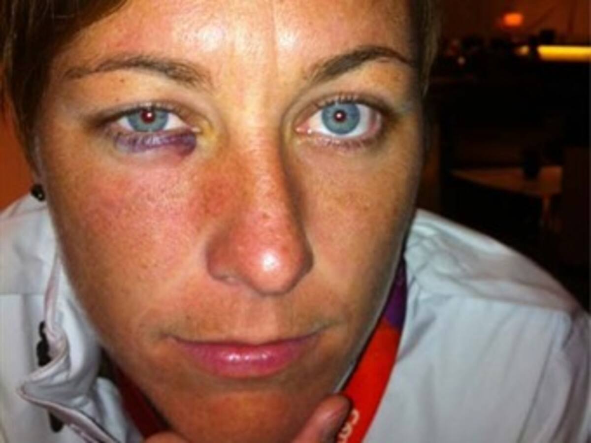 La futbolista Lady Andrade fue suspendida por golpear a Abby Wambach