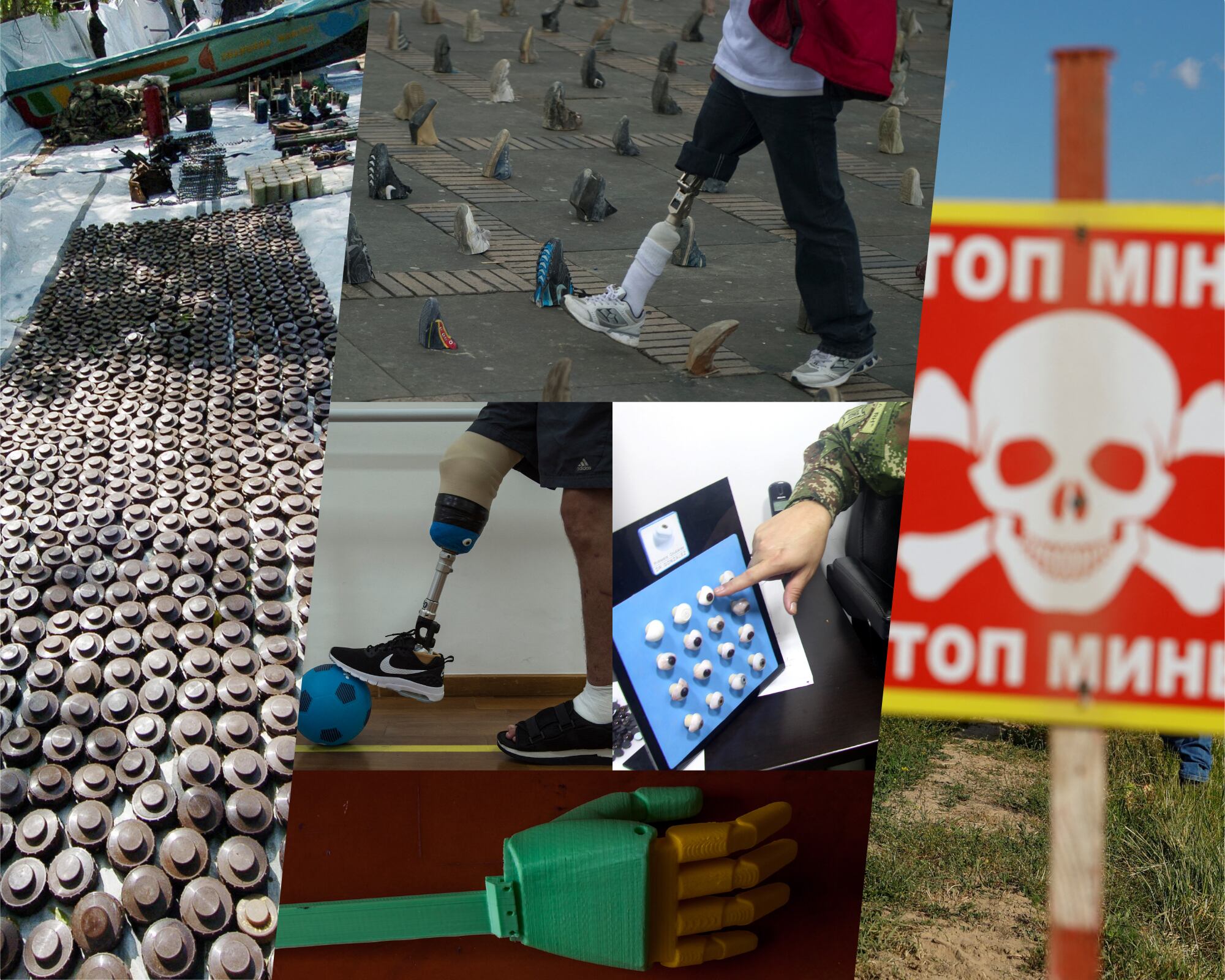 Un informe de Humanity & Inclusion advierte que las personas víctimas de minas antipersona y otro tipo de explosivos carecen de acceso a tratamientos de rehabilitación. 
(Foto: Caracol Radio / Getty)