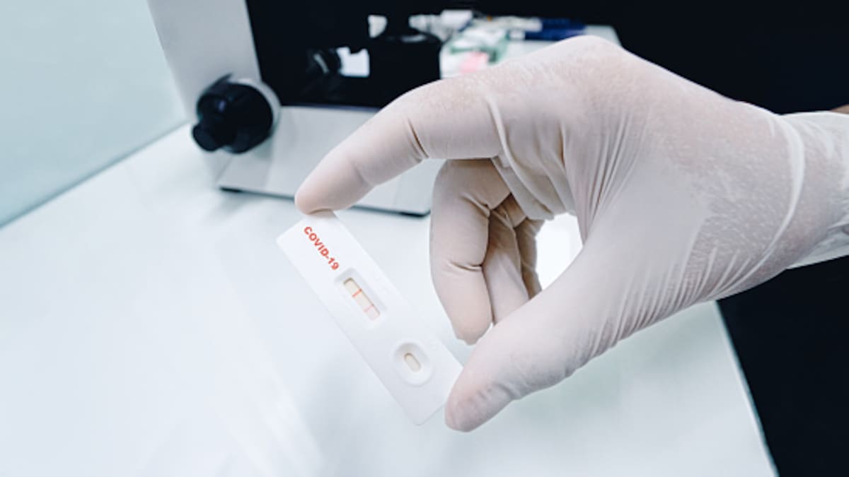 ¿Cuánto costaría una prueba rápida de COVID-19 en una droguería en Colombia?