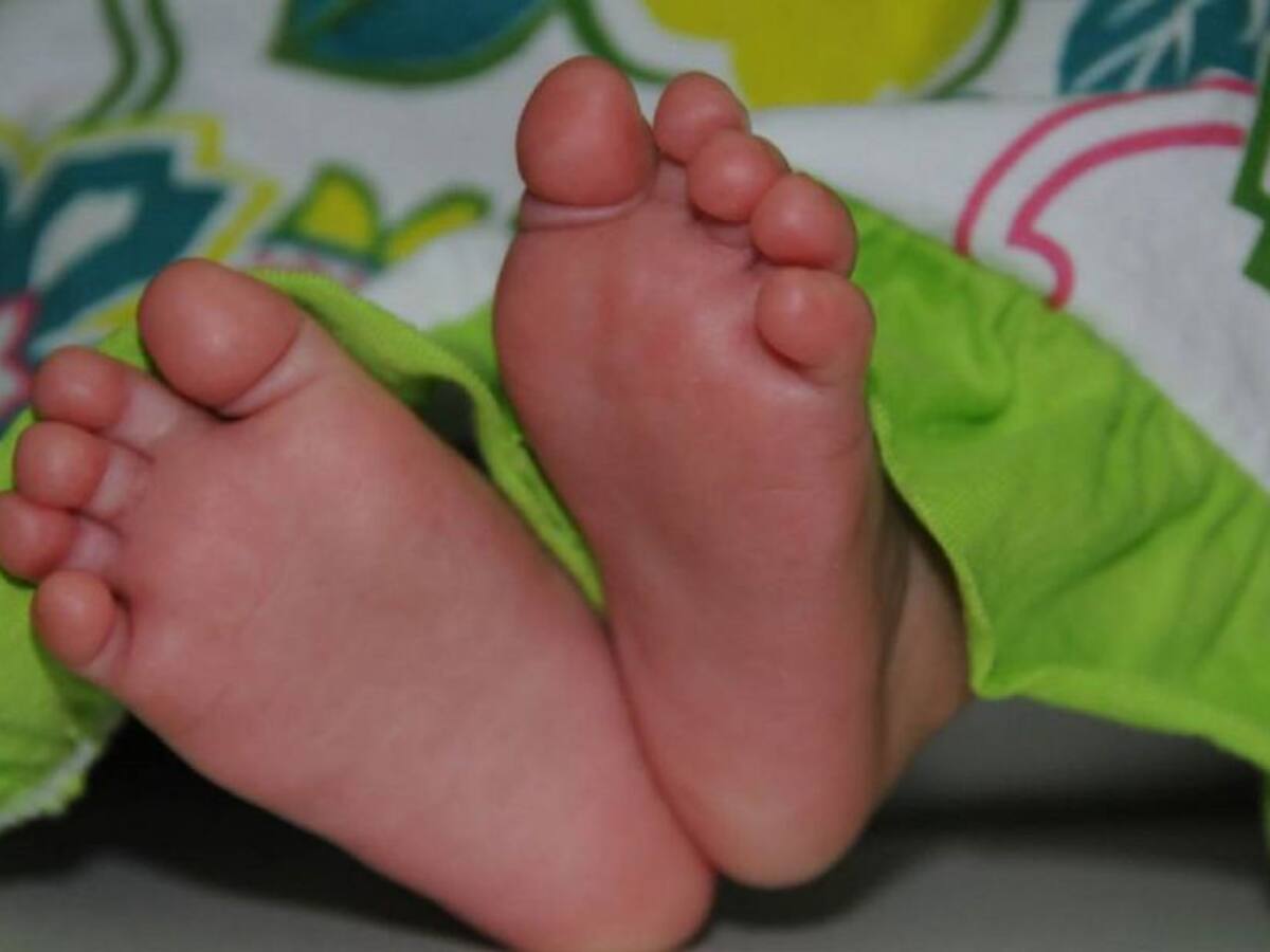 Una bebé de 7 meses se quemó con agua caliente en Medellín