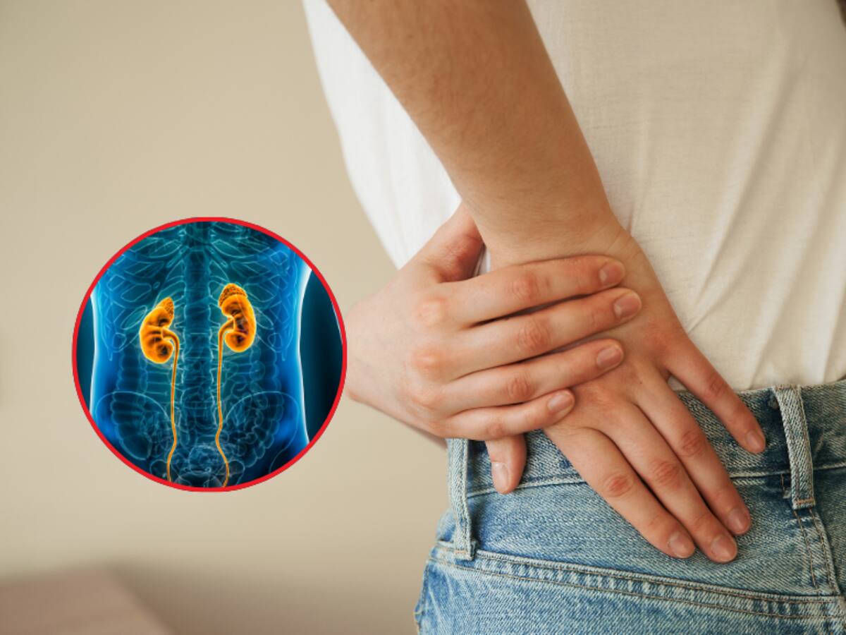 3 afecciones comunes que pueden llevar a diálisis: doctor advierte riesgos por no cuidairse