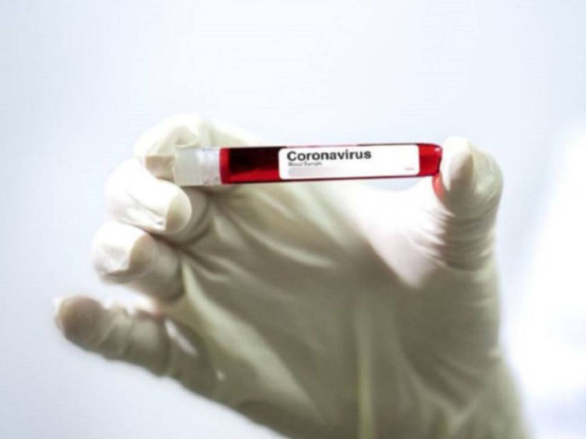 Con nueva tecnología se apoyará la toma de muestras de COVID-19 en Caldas