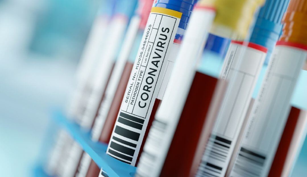 Las comunas 4, 7, 9, 12 y 20 de Cali, clasificadas con alto riesgo de contagio.