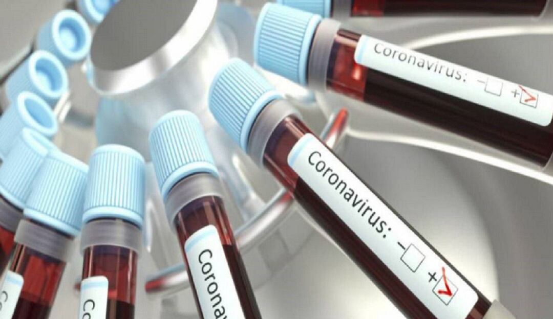 Aumento del COVID-19 