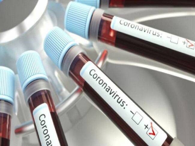 Aumento del COVID-19