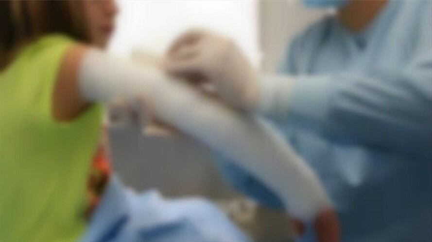 Menor quemado con pólvora. Foto: Cortesía