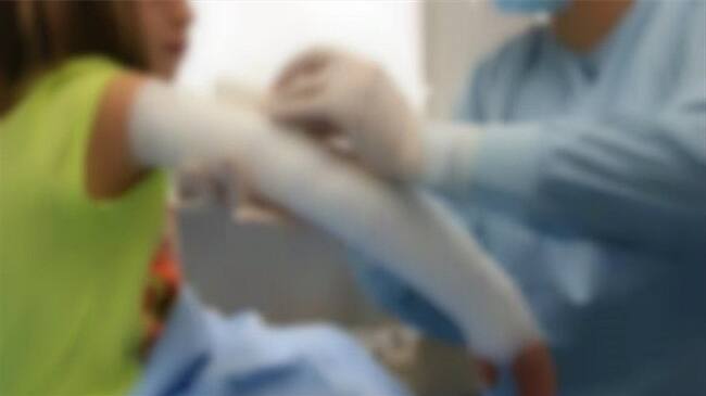 Menor quemado con pólvora. Foto: Cortesía