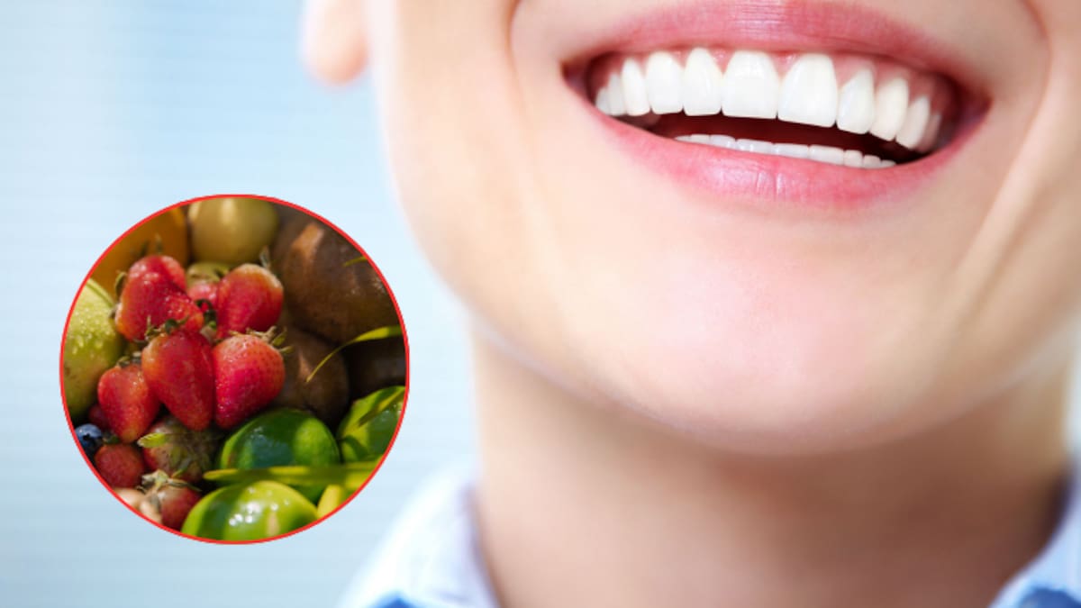 5 alimentos que pueden blanquear los dientes de forma natural