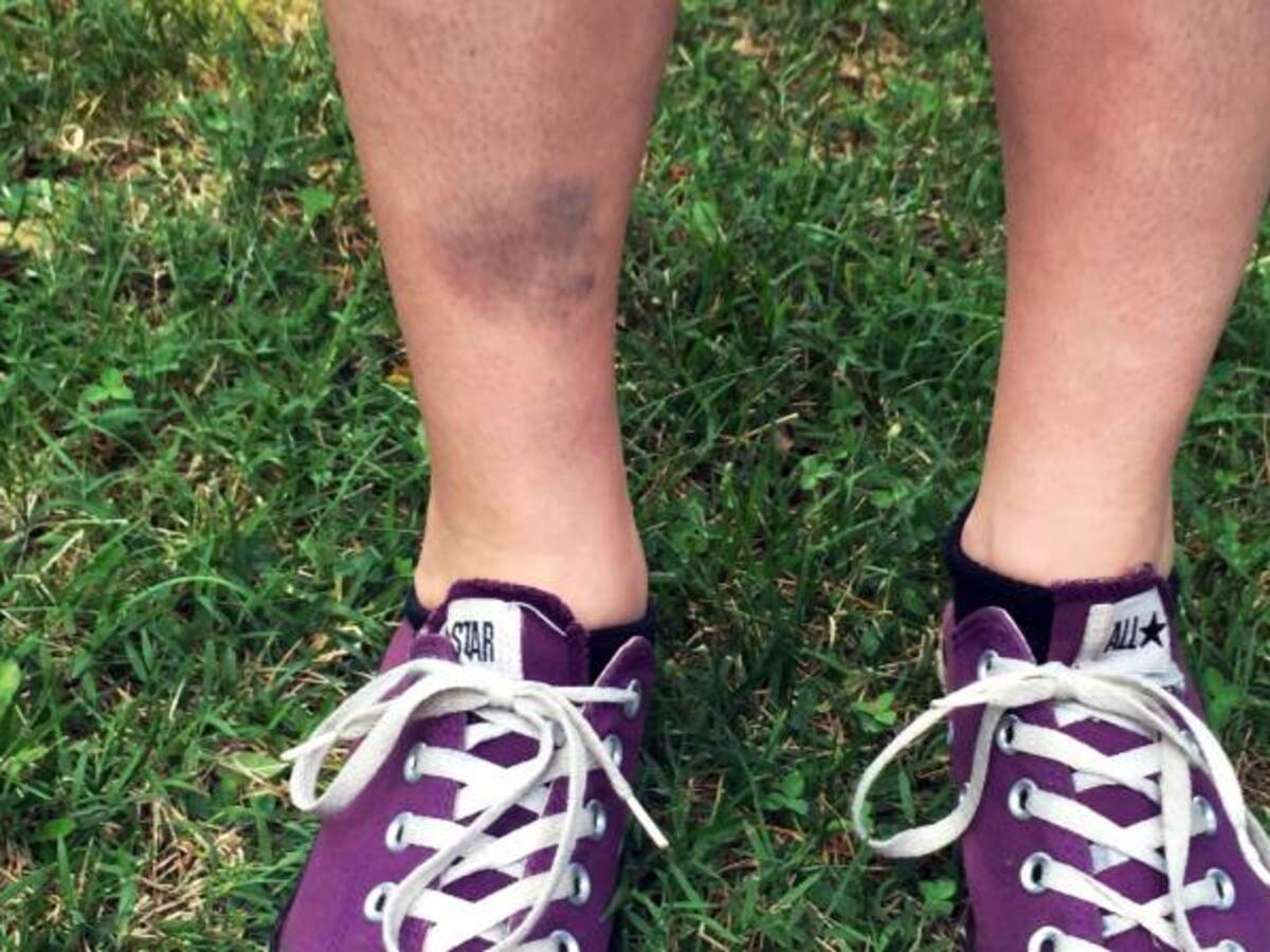 Pokemon GO ha causado algunos accidentes a jugadores despistados