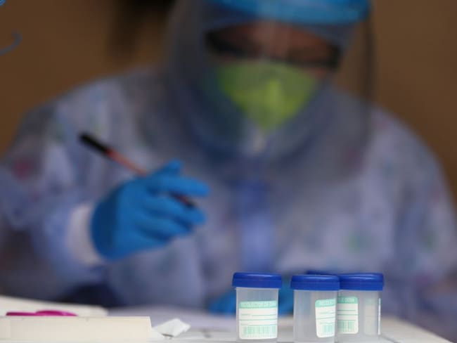 Supersalud alerta por represamiento de 30.470 pruebas en laboratorios