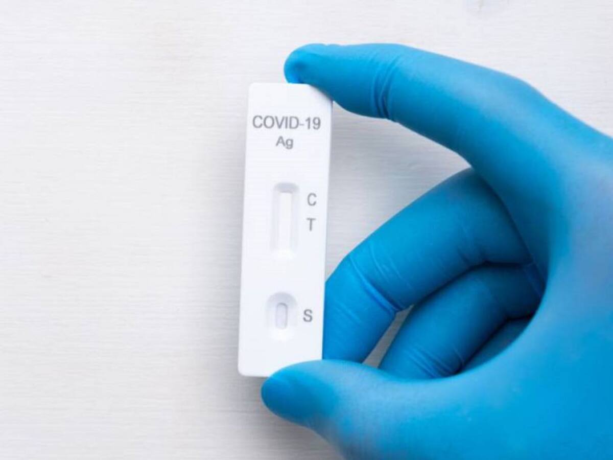 Fenalco Quindío refuerza llamado de comercializar pruebas caseras de COVID