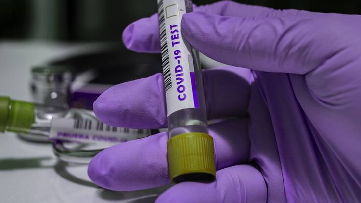 Fallas en procesamiento de pruebas COVID dejarían millonarias pérdidas