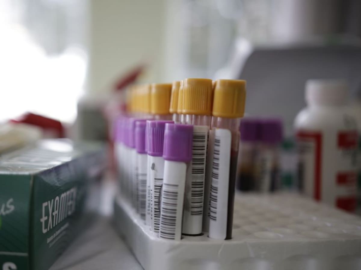 Cantidad de pruebas superó capacidad del INS