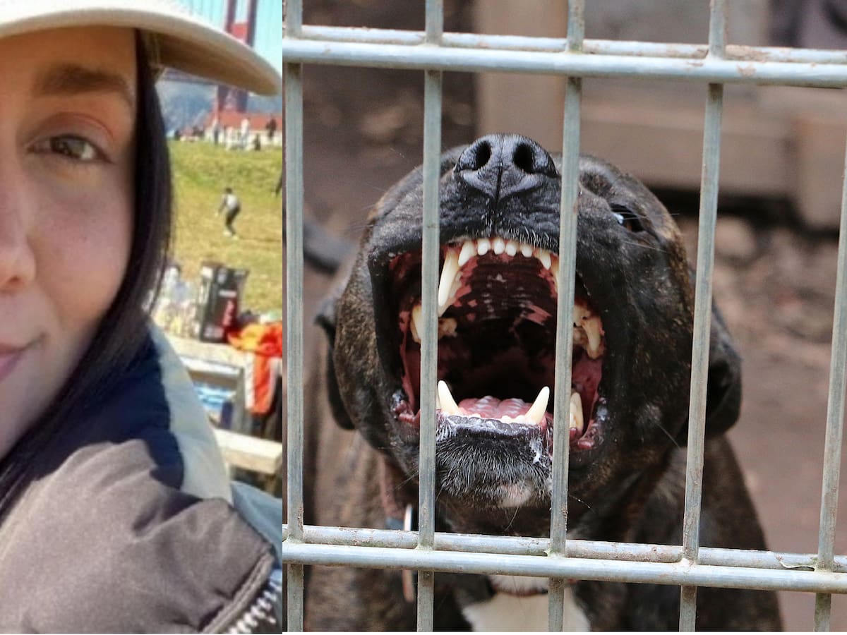 Les dieron la visa a los padres de la Santandereana atacada por perros en Estados Unidos