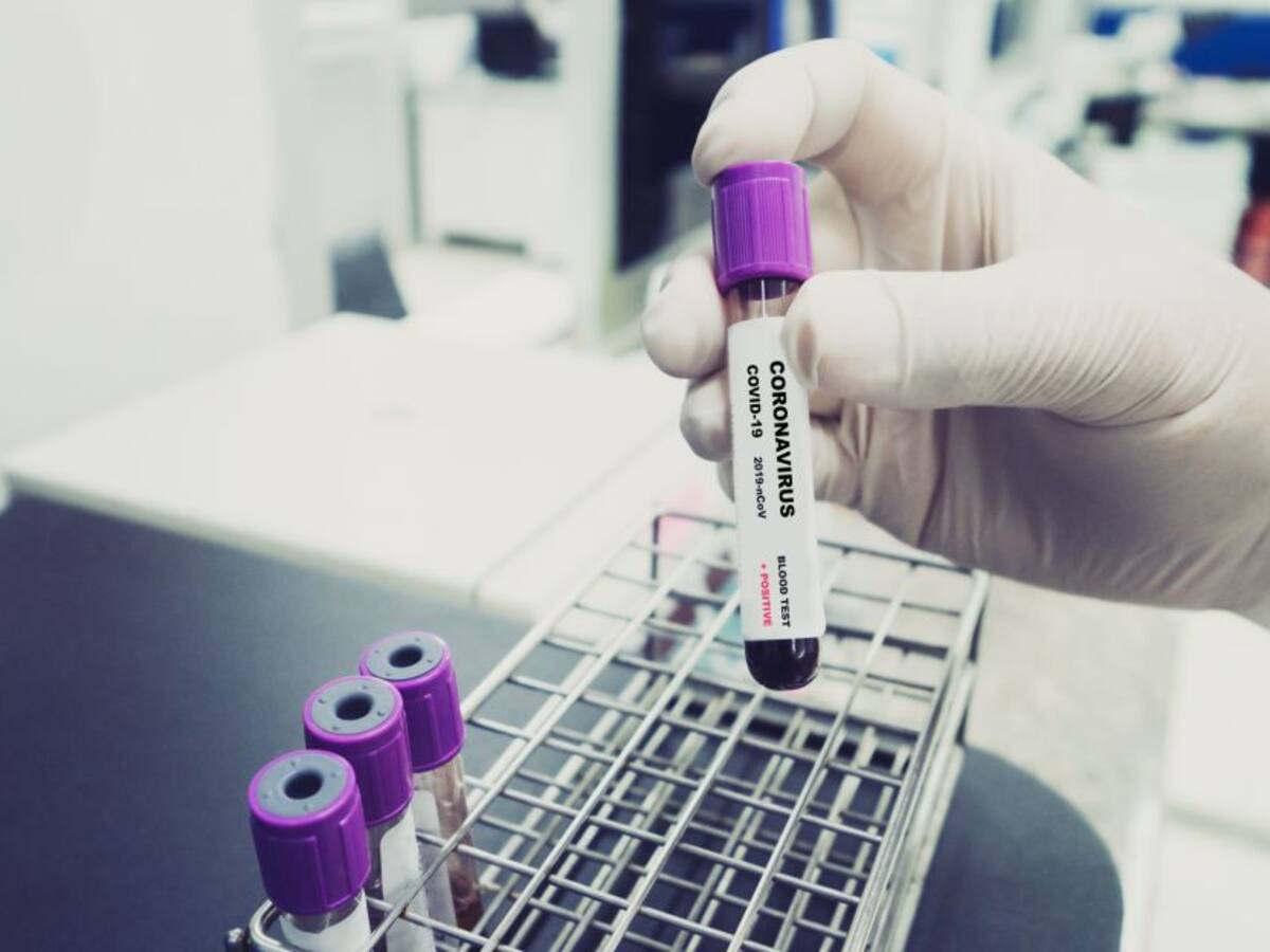 Reportan 28 casos positivos de coronavirus en cárcel La Vega de Sincelejo