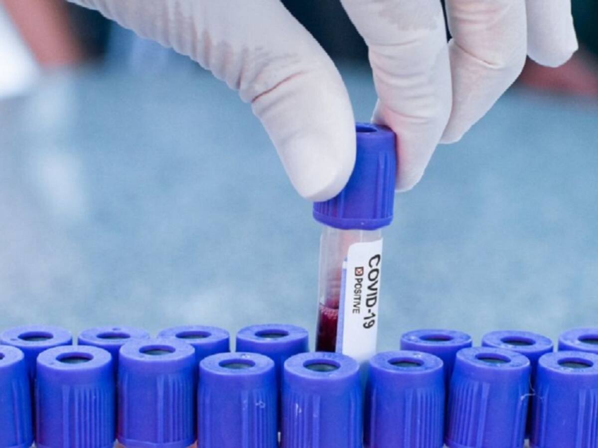 Monitoreo a casos de COVID-19 para levantar alerta roja