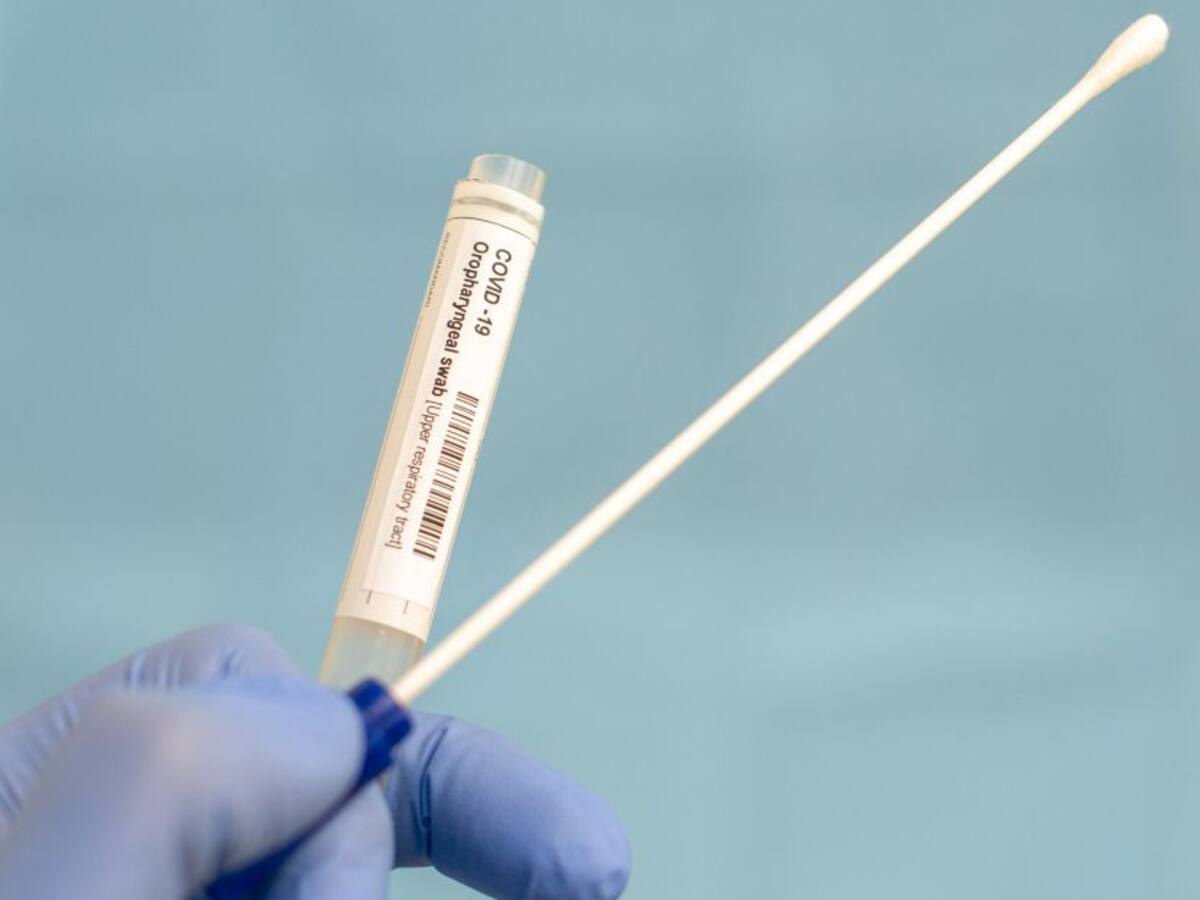 Dos muertos por COVID-19 en Sucre