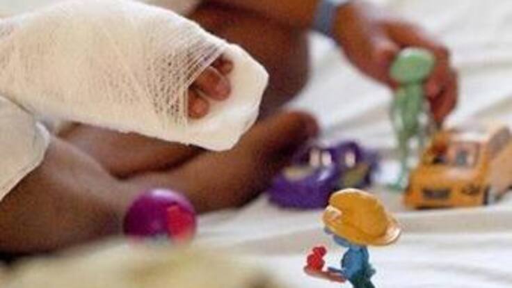 Sin empezar fin de año, reportan 8 niños quemados con pólvora en Antioquia