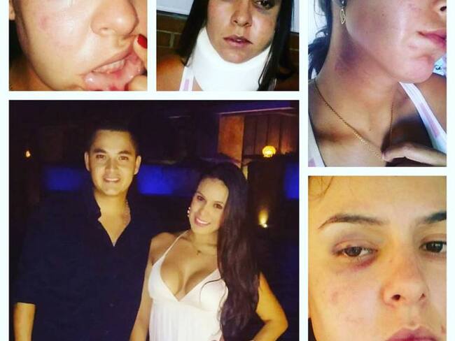 Modelo antioqueña fue golpeada por su novio en República Dominicana