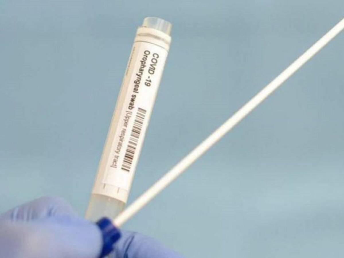 200 pruebas diarias realizan laboratorios en pruebas COVID-19 en el Quindío