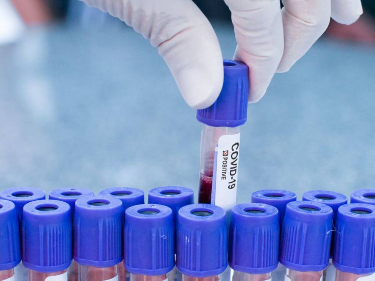 Lo que necesitamos saber sobre las olas del coronavirus