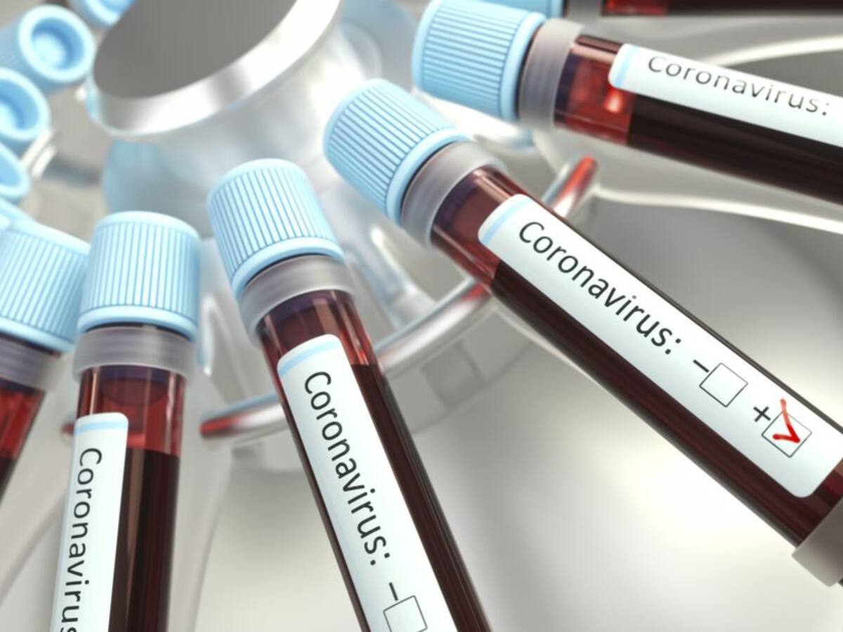 Argentina suspende actividades deportivas en marzo por coronavirus