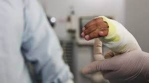 Decembrina del 2022 se registraron 34 casos de lesiones con por pólvora.