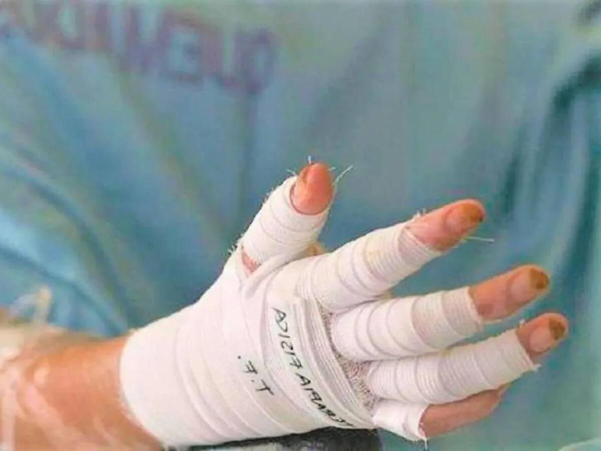 20 lesionados por pólvora en el Huila durante la celebración del 31 de diciembre.